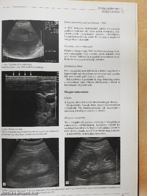 Ultraszonográfia - CD-vel