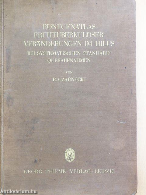 Röntgenatlas Frühtuberkulöser Veränderungen im Hilus
