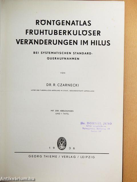 Röntgenatlas Frühtuberkulöser Veränderungen im Hilus