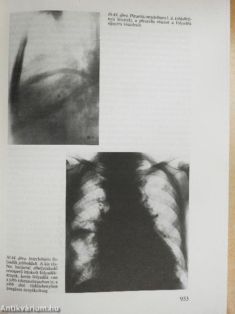 A belgyógyászat alapvonalai 1-3.