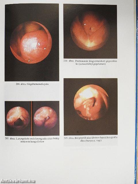 Fül-, orr-, gégegyógyászat
