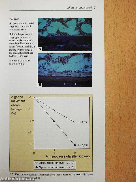 Az osteoporosis klinikai kézikönyve