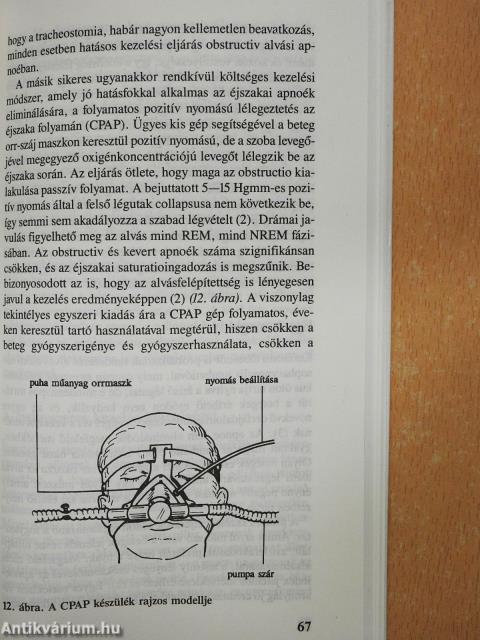 Légzészavarok alvás alatt (dedikált példány)