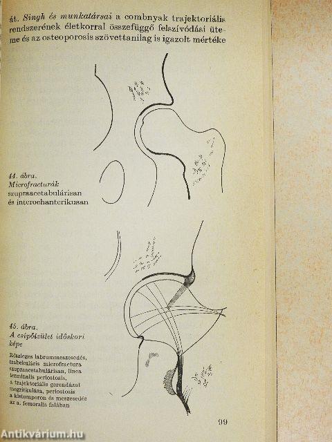 A mozgásszervek röntgenvizsgálata az idős korban