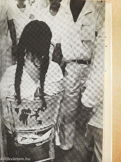 Téboly/terápia/stigma