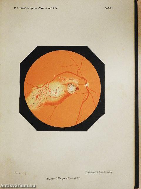 Zeitschrift für Augenheilkunde 1907/XVII.