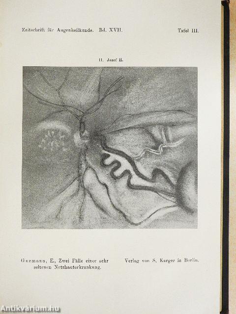 Zeitschrift für Augenheilkunde 1907/XVII.