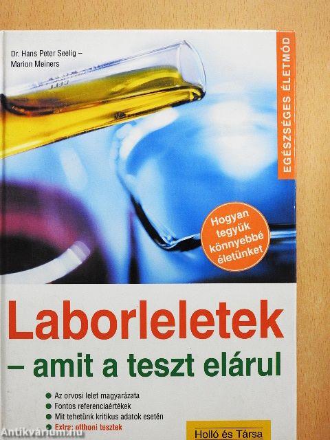Laborleletek - amit a teszt elárul