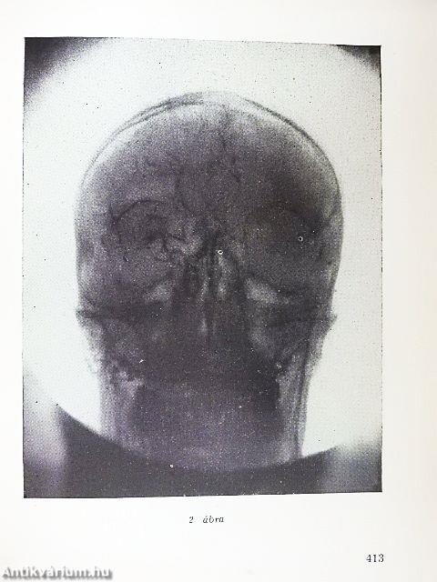 Ideggyógyászati tanulmányok