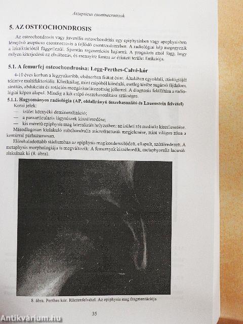 Csont-ízületi radiológia