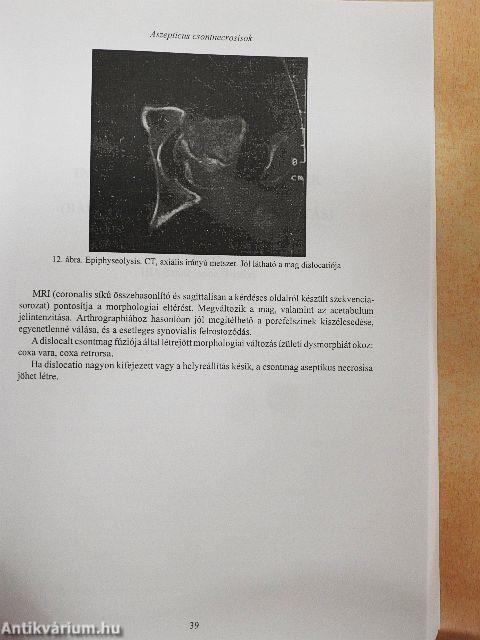 Csont-ízületi radiológia