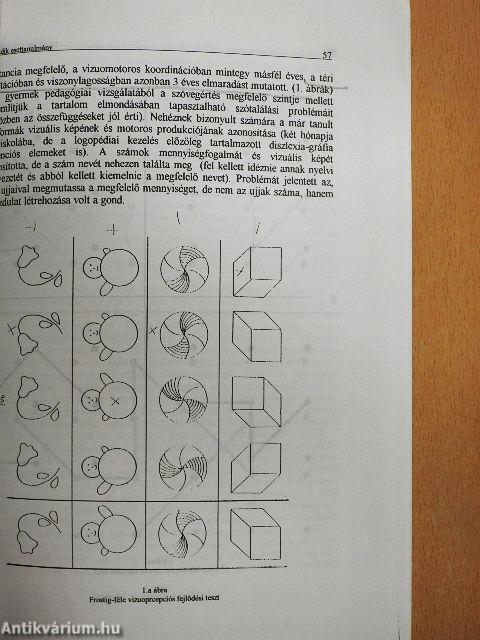 Pszichomotoros fejlesztés a gyógypedagógiában III.