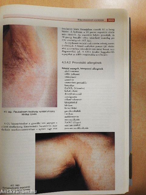 Klinikai immunológia