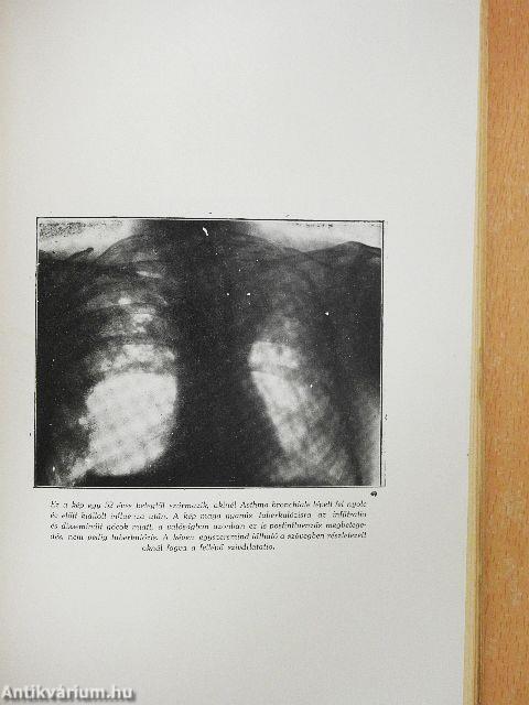 Allergia és allergiás betegségek