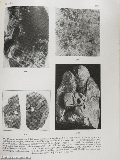 Részletes kórbonctan II.