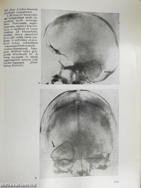 A klinikai neurológia alapjai