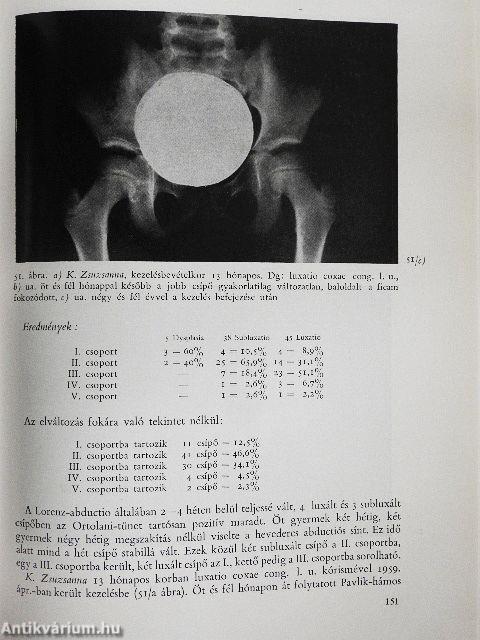 A világra hozott csípőficam és korai konzervatív kezelése