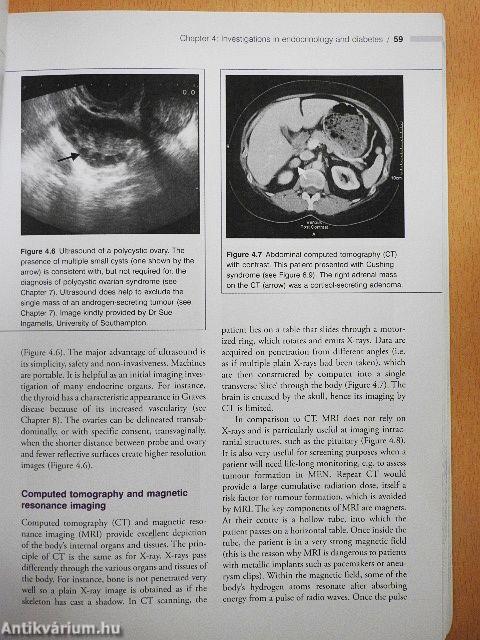 Essential Endocrinology and Diabetes