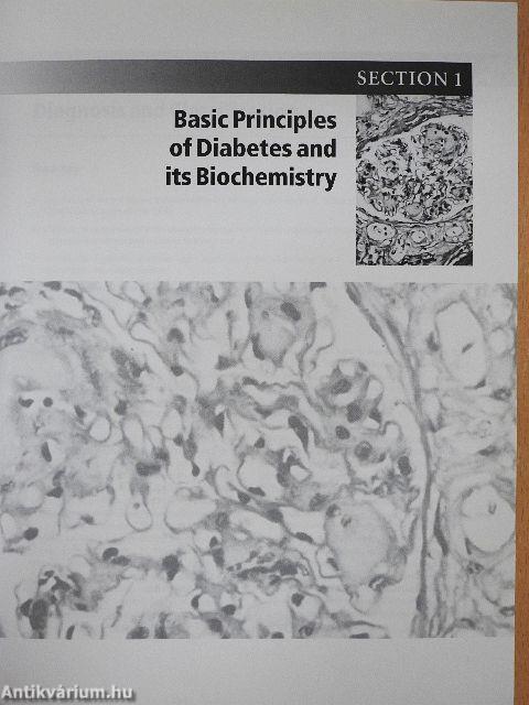 Diabetes and its Management