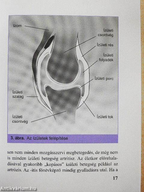 Reumatoid artritisz