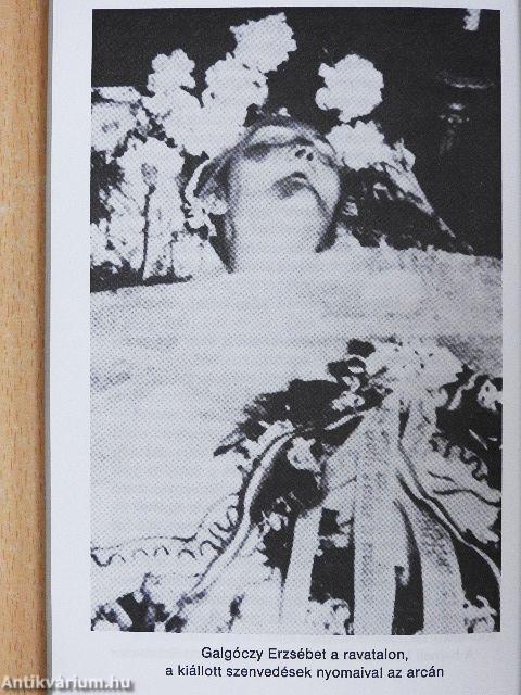 A szeretet nem ismer határt