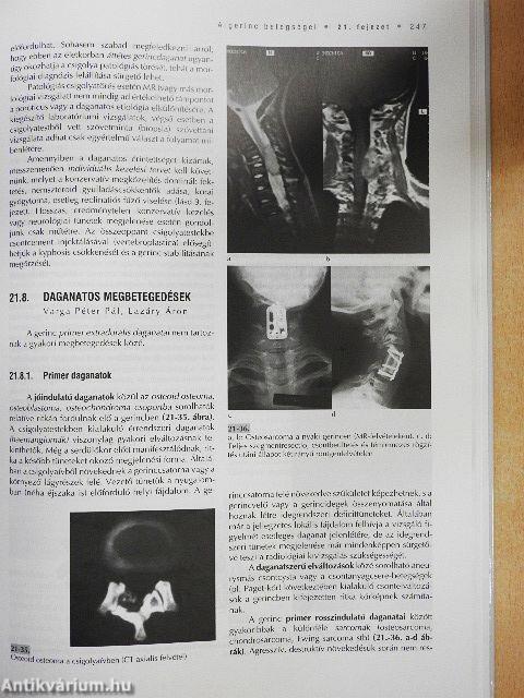 Az ortopédia tankönyve