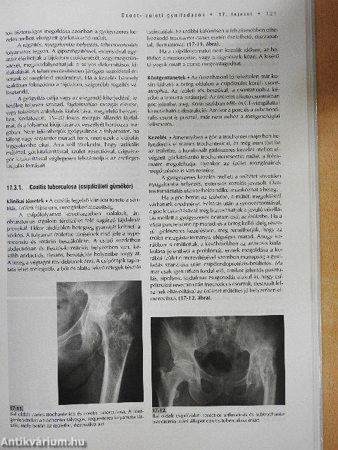 Az ortopédia tankönyve