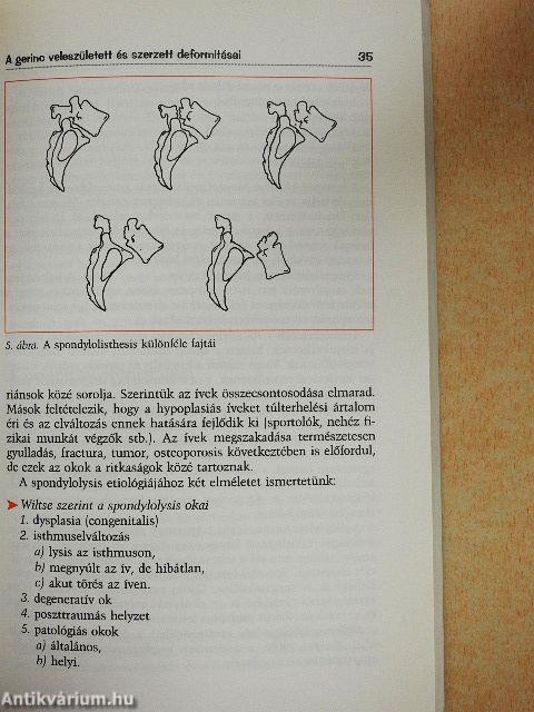 Gerincbetegségekről