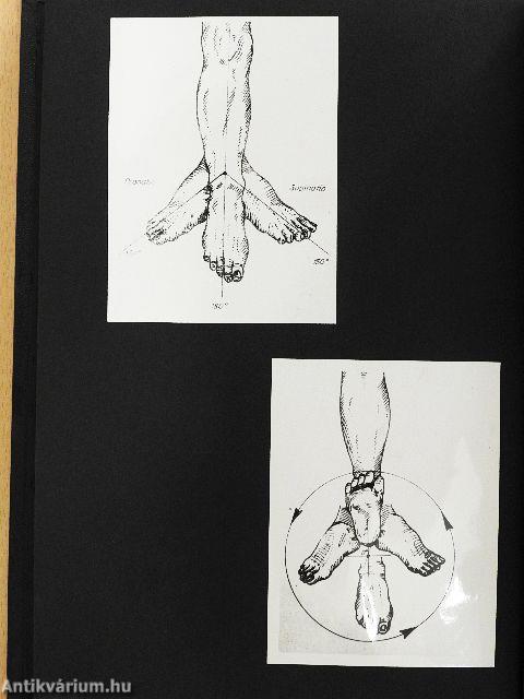 Egyes statikai lábbetegségek megelőzése jól szerkesztett gyermekcipővel I-II.