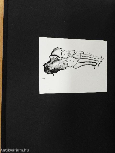 Egyes statikai lábbetegségek megelőzése jól szerkesztett gyermekcipővel I-II.