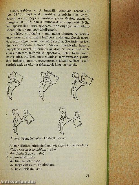 A gerincbetegségek differenciáldiagnosztikája az ortopédiában