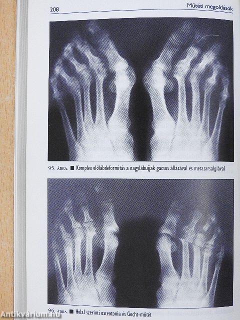 A láb mozgásszervi betegségei