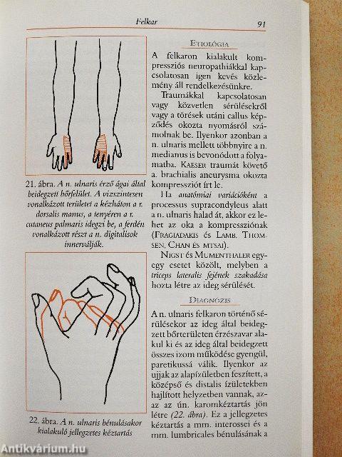 Alagút szindrómák és egyéb kompressziós mononeuropathiák