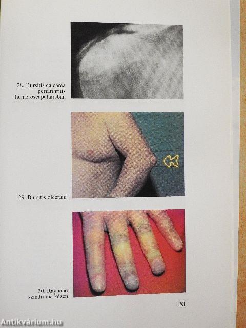 Gyakorlati reumatológia