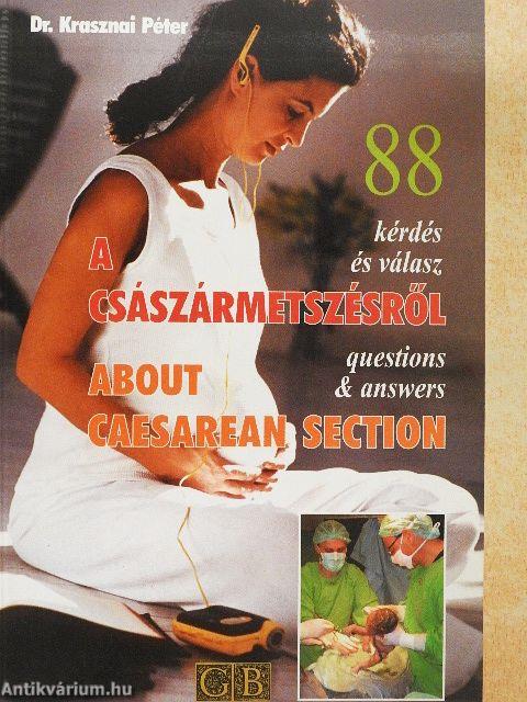 88 kérdés és válasz a császármetszésről