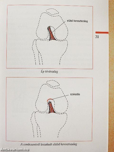 Artroszkópiára várva