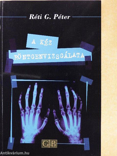 A kéz röntgenvizsgálata