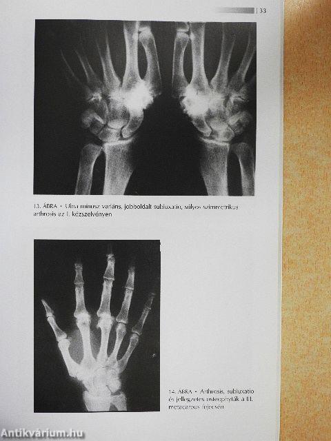 A kéz röntgenvizsgálata