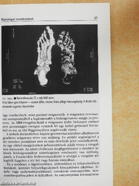 A láb mozgásszervi betegségei