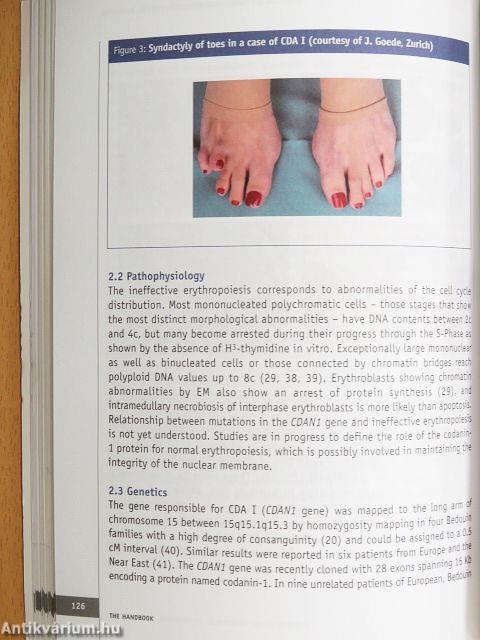 Disorders of iron homeostasis, erythrocytes, erythropoiesis