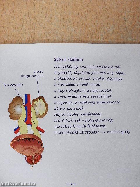 Mi az oka? Mit tehetek ellene?