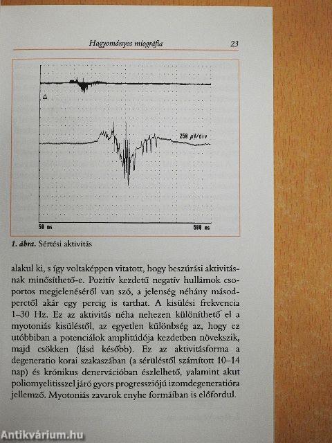 Klinikai elektromiográfia