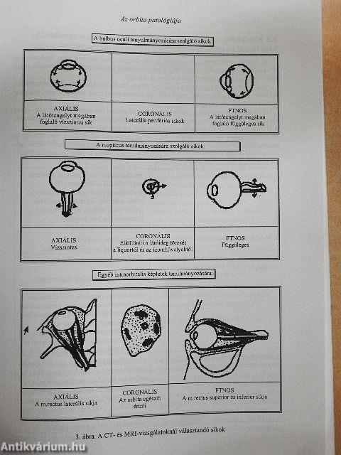 Neuroradiológia és fül-, orr-, gégészeti radiológia