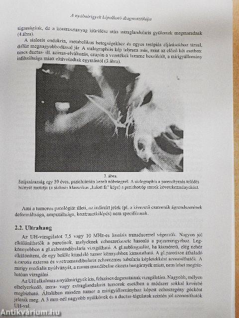 Neuroradiológia és fül-, orr-, gégészeti radiológia