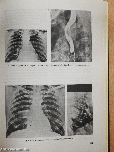 A radiológia alapfogalmai