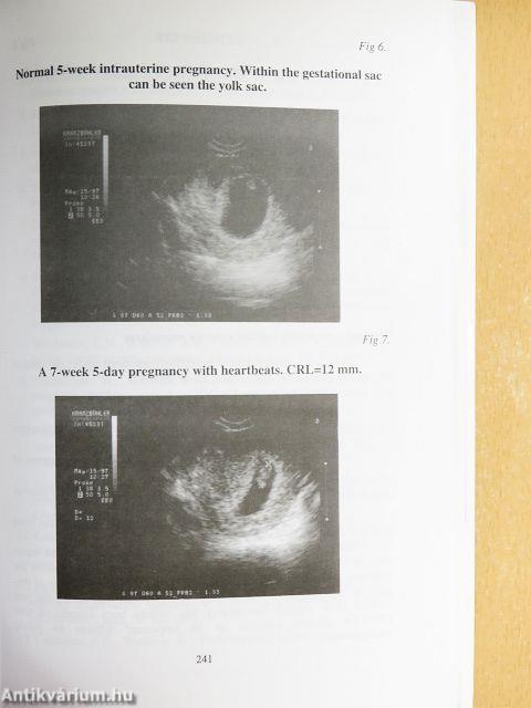 Recent Progress on Obstetrics and Gynecology