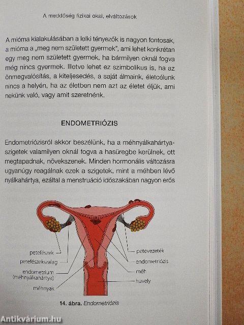 Meddőségből termékenység
