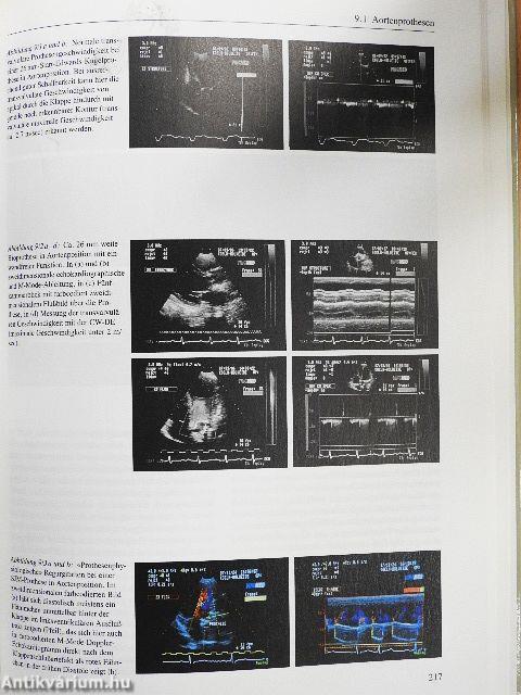 Praxis der konventionellen und farbcodierten Doppler-Echokardiographie