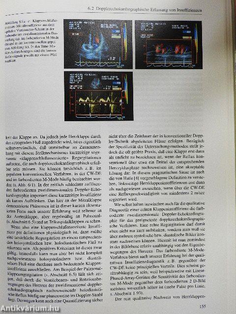 Praxis der konventionellen und farbcodierten Doppler-Echokardiographie