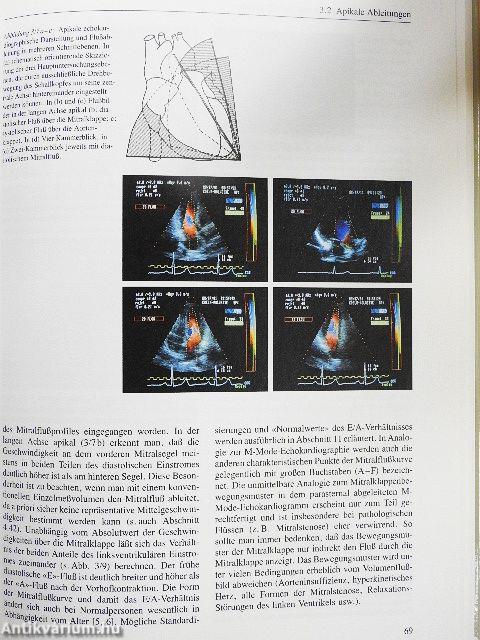 Praxis der konventionellen und farbcodierten Doppler-Echokardiographie